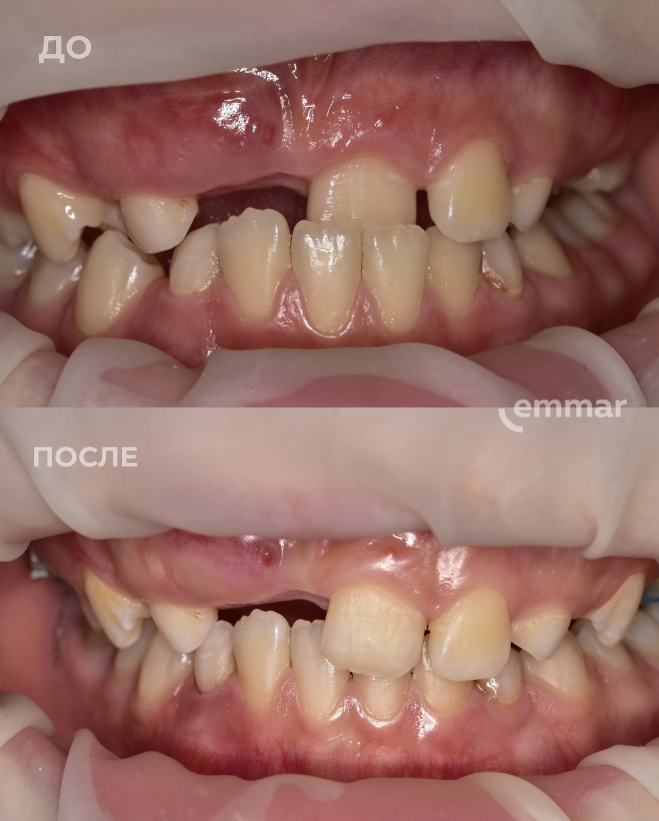 Ортодонтия